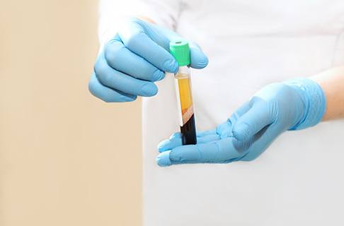 Dentist holding a vial with a blood sample