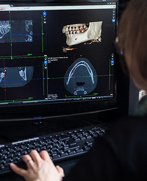 Dental team member looking at scans of a patient’s jaw