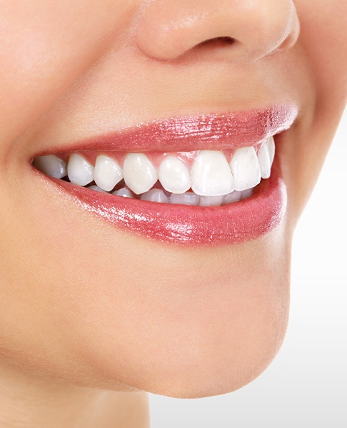 Person smiling with flawless teeth and gums