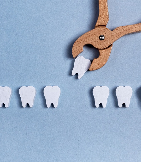 Illustration of a tooth being extracted
