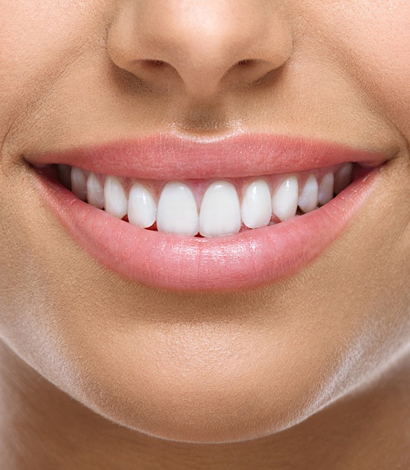 Close up of a flawless smile after esthetic gingival recontouring in Dallas