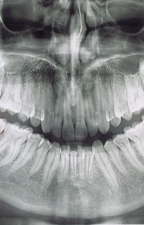 Close up of man with earrings and gold chain