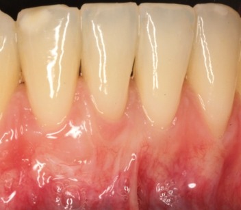 Teeth that all appear to be the right size