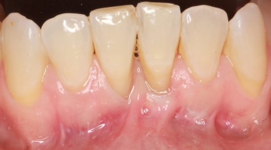 Healthier looking teeth and gums