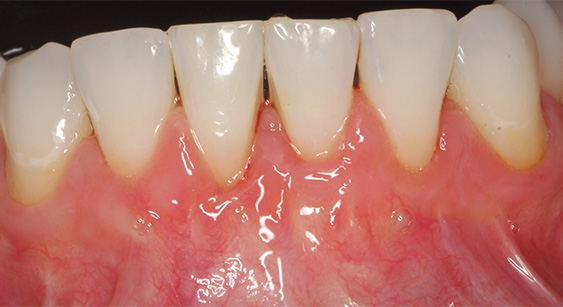 Close up of brighter looking teeth
