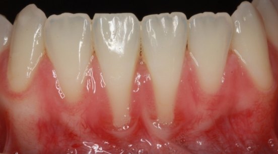 Unusually long-looking teeth