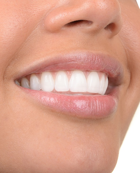 Close up of a flawless smile after crown lengthening