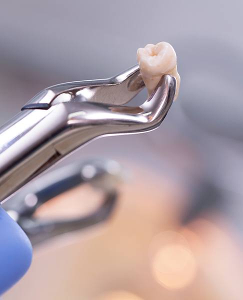 Metal clasp holding an extracted tooth