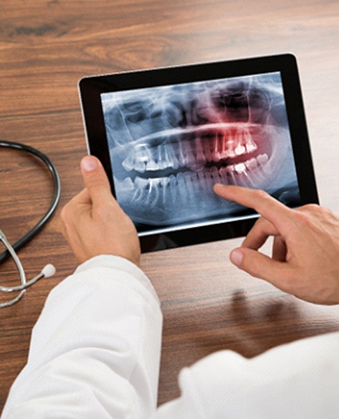 Dentist holding a tablet showing an X ray of teeth