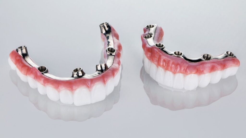 A photo of implant dentures